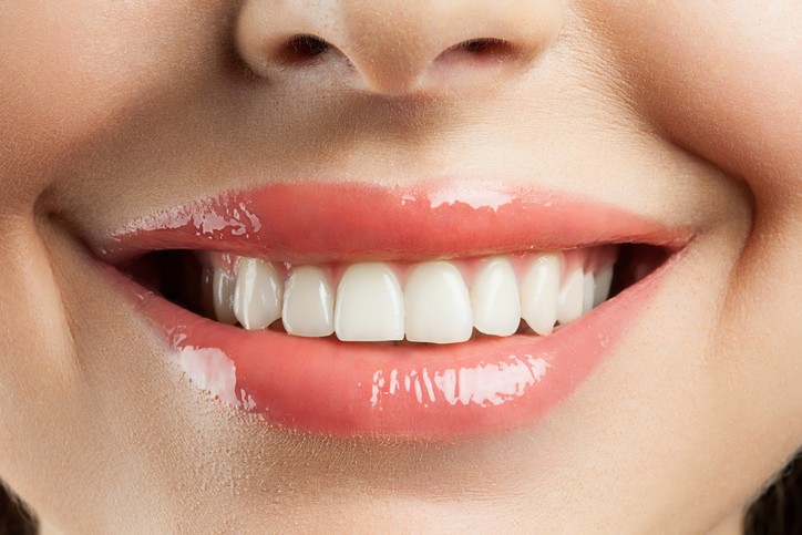 cosmetic dentist in Oregon City